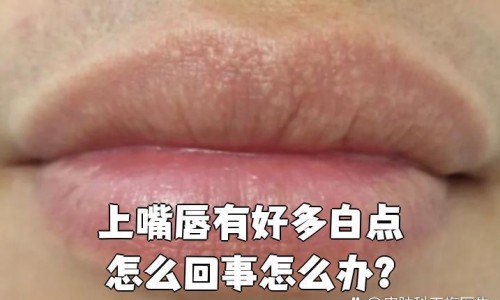 月经期可以根管填充吗-大姨妈期间做填充网 - 来月经可以填充太阳穴吗,月经期可以做面部填充吗